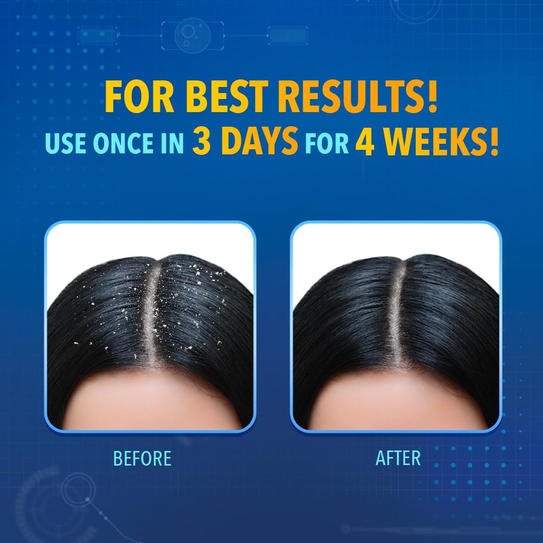 Scalpe+ Expert - Bottle of 75ml Anti Dandruff Shampoo for Men and Women with Ketoconazole and ZPTO