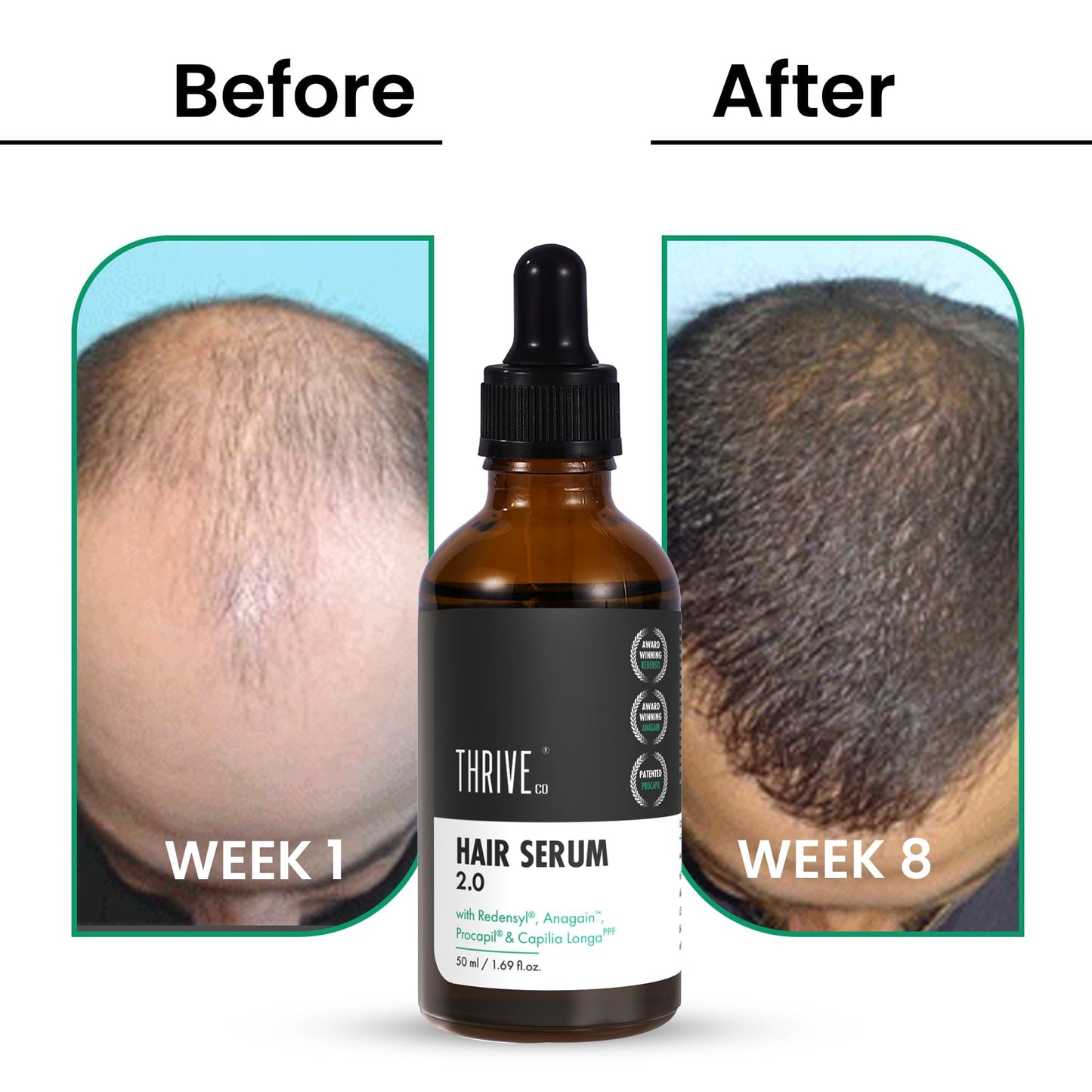 ThriveCo Hair Growth Serum 2.0 For Hair Growth & Hair Fall Control | with Redensyl + Anagain + Rosemary + Procapil + Capilia Longa | For Men & Women | 50ml