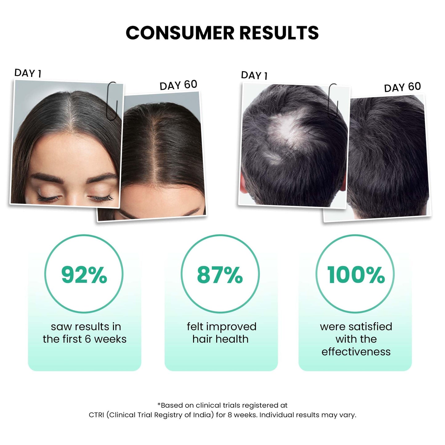 ThriveCo Anti-Grey Hair Prime Serum | Reverses & Limits Hair Greying | Arcolys + Biotin + Black Tea Extract | Light-Weight, Non-Sticky & Odourless | For Men and Women | 50 Ml