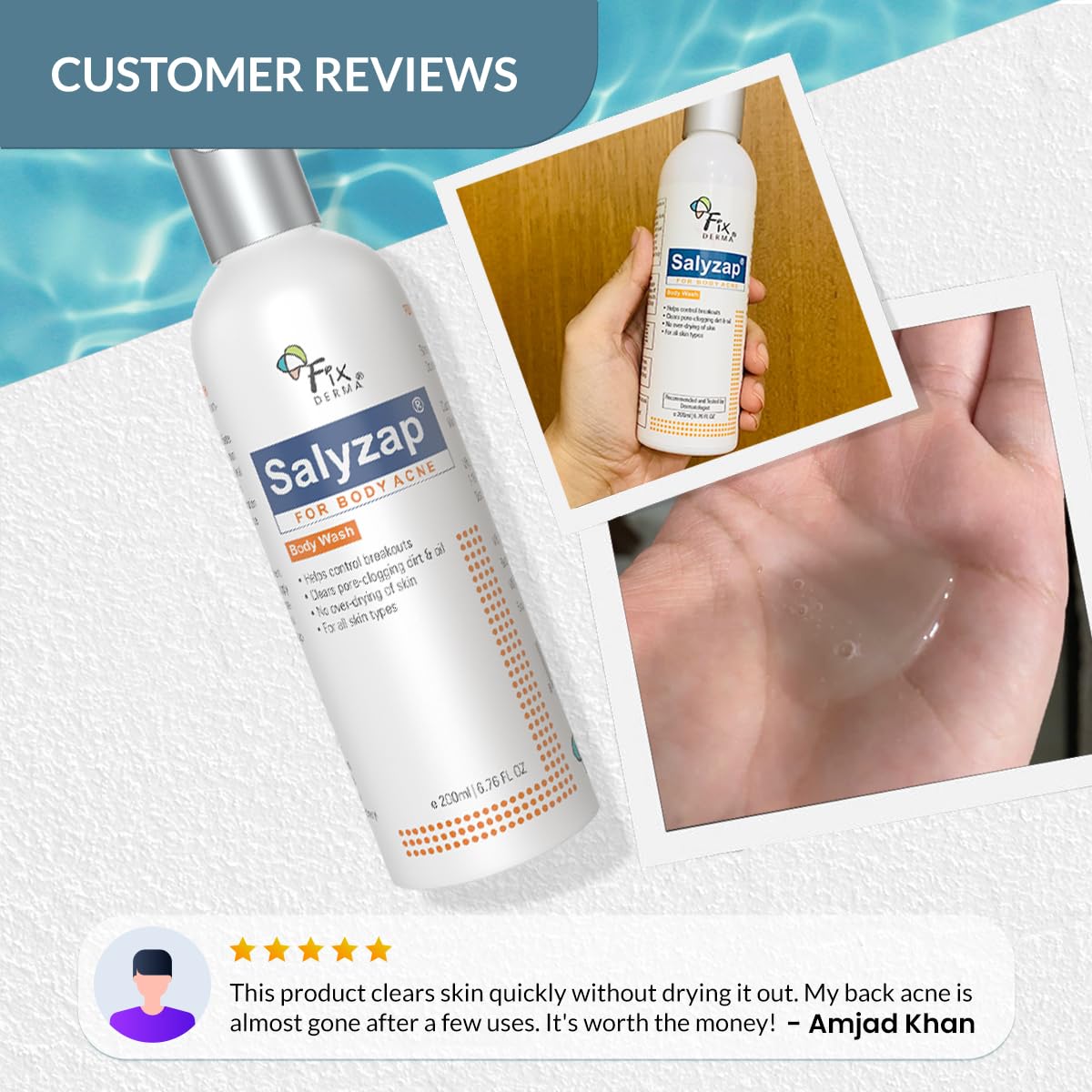 4x FIXDERMA Salyzap 2% Salicylic Acid Body Wash - 200ml each (Pack of 4)